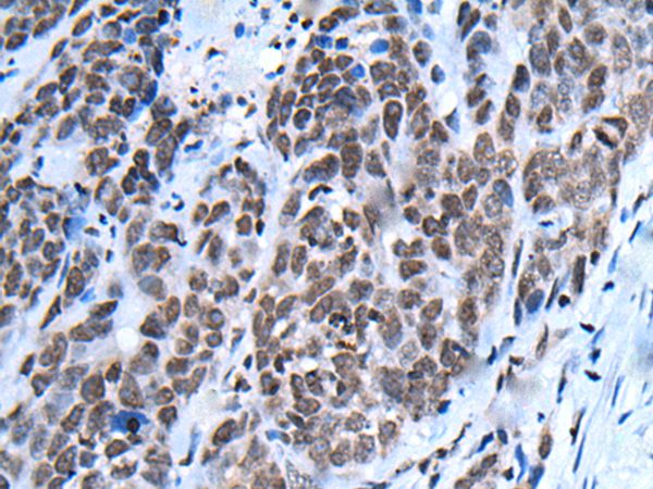 NHEJ1 Antibody