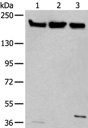 XRN1 Antibody