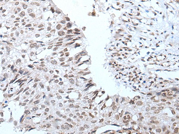 WIPF2 Antibody