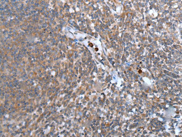 WISP2  Antibody