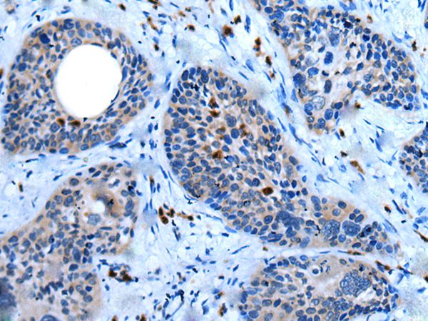 WISP2  Antibody