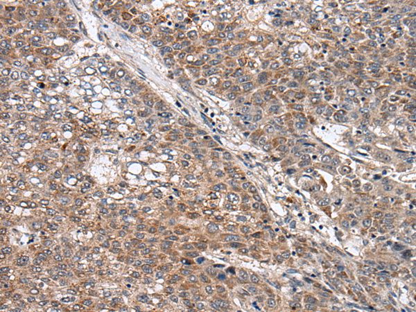 WNT9B Antibody