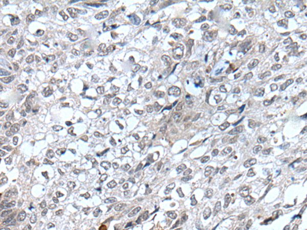 FLT4 Antibody