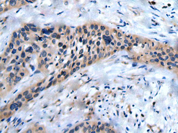 SLC17A8  Antibody