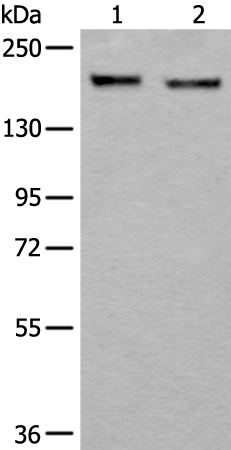 ERBB2 Antibody