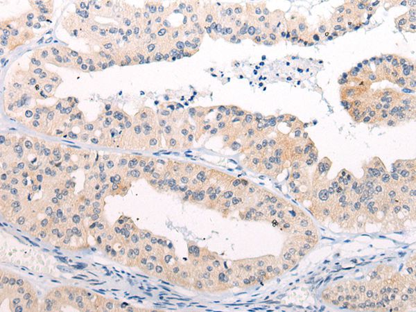 ANAPC15 Antibody