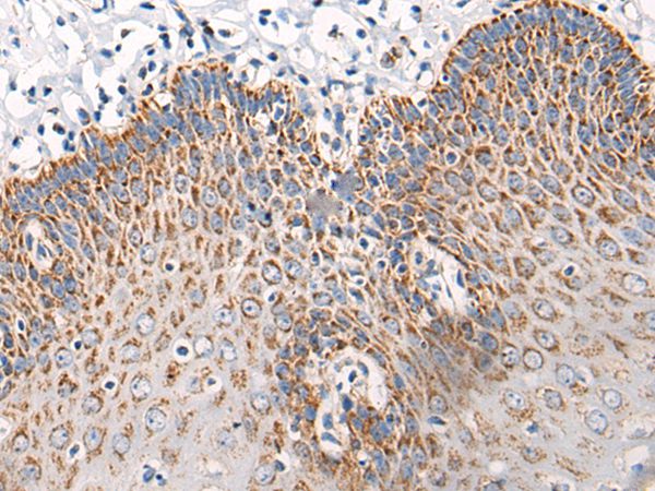 C14orf2 Antibody