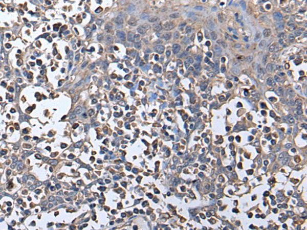 ZNHIT1 Antibody