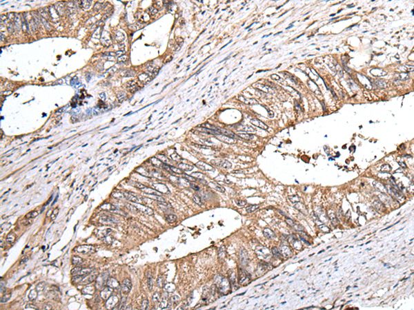 ZNHIT1 Antibody