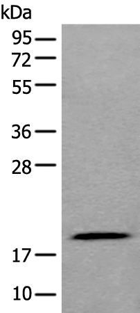 ZNHIT1 Antibody