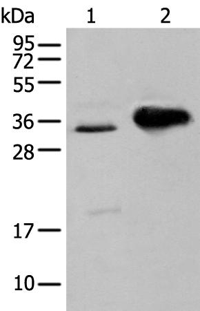 ATP6V1E2 Antibody