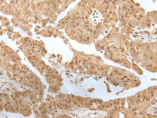 ZNF24 Antibody