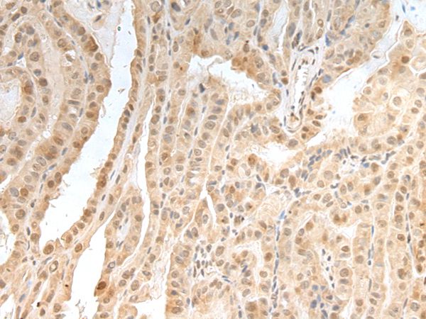 ZNF24 Antibody