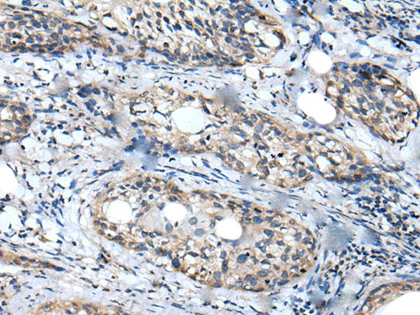 WDFY2 Antibody