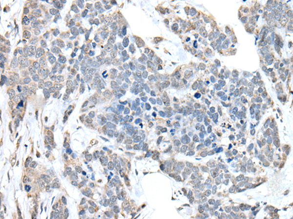 ANKRD27 Antibody