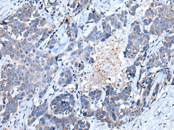 SFRP5 Antibody