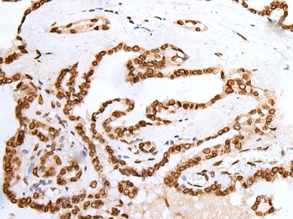 PIF1 Antibody