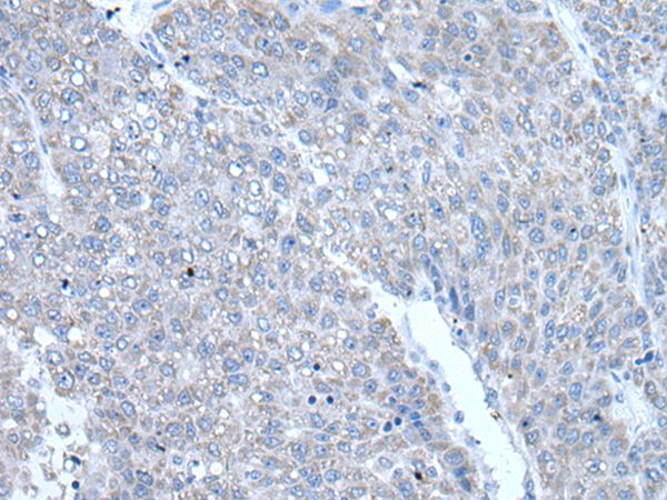 RAC2 Antibody