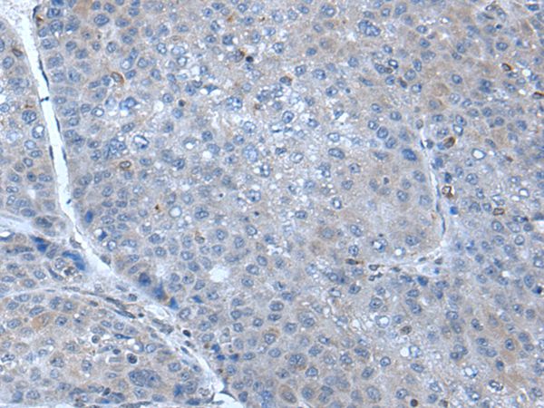 SCGB3A1 Antibody