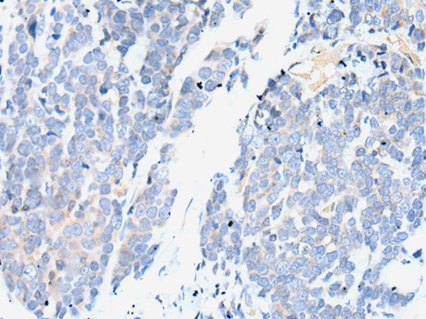 SMC2 Antibody