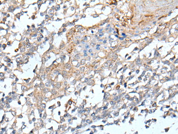 STARD4 Antibody