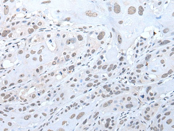 TRIM23 Antibody