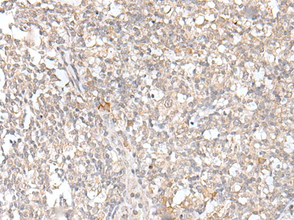 KLRC3 Antibody