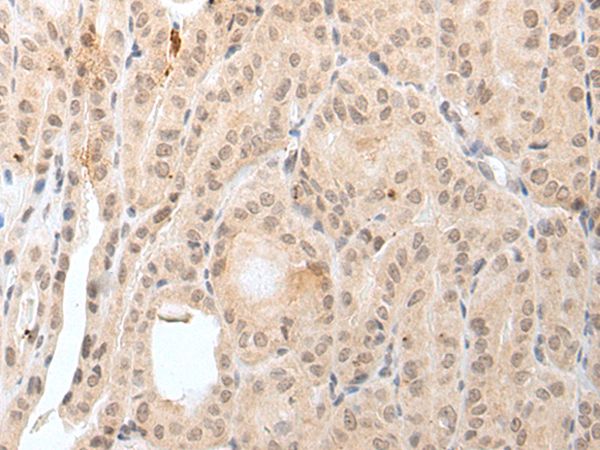 KCNH1 Antibody