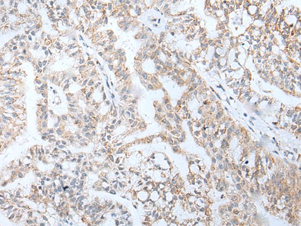 HOXA5 Antibody