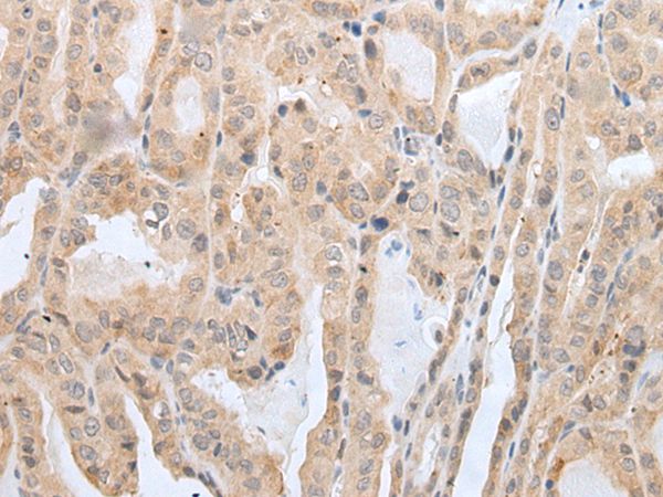 PRH2 Antibody