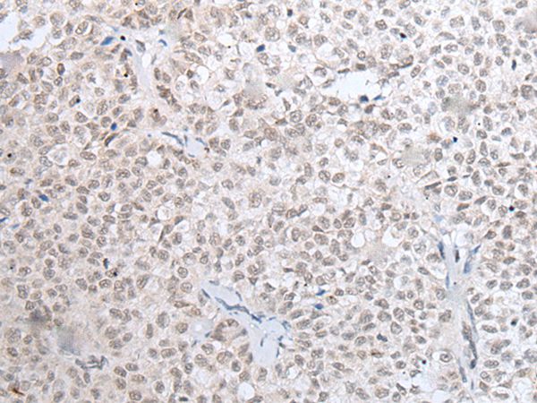 HOXC11 Antibody