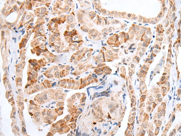 HOXC11 Antibody