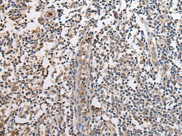 SLC8A1 Antibody