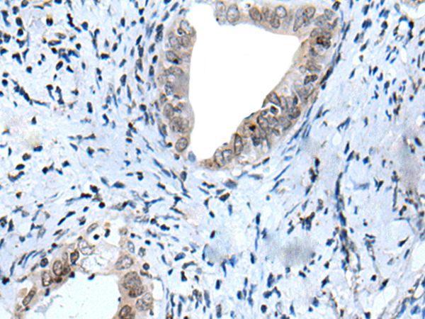 HOXD12 Antibody