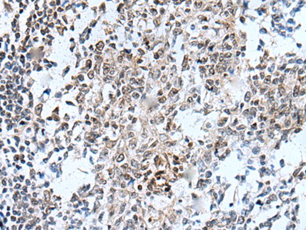 HOXD12 Antibody