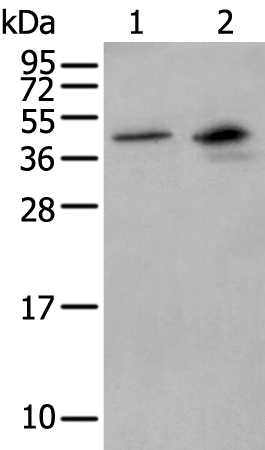 MAGEB1 Antibody