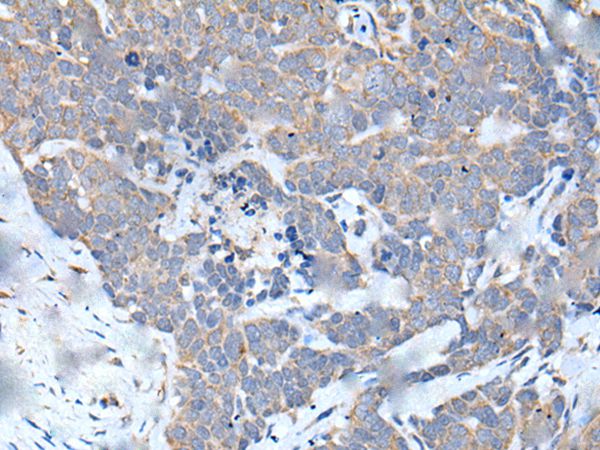 MATN2 Antibody