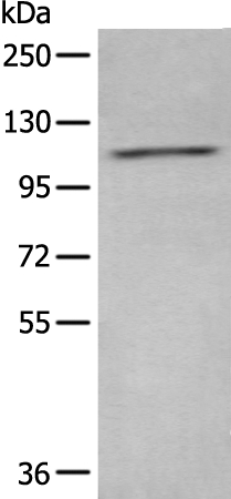 ADCY2 Antibody