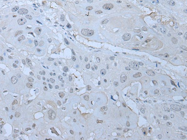 HUWE1 Antibody