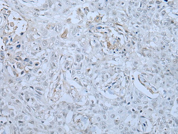 HUWE1 Antibody