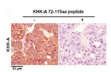 KHK Isoform A Antibody