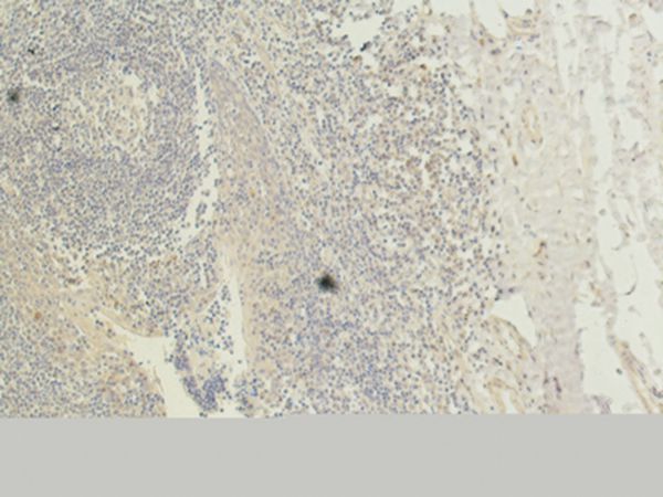 CD1 Monoclonal Antibody(9H6)