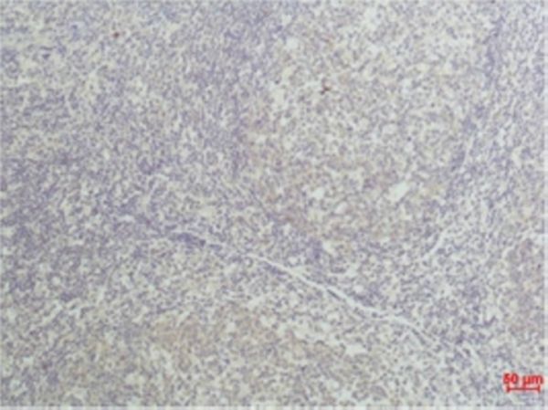 TNF α Monoclonal antibody(Q34)