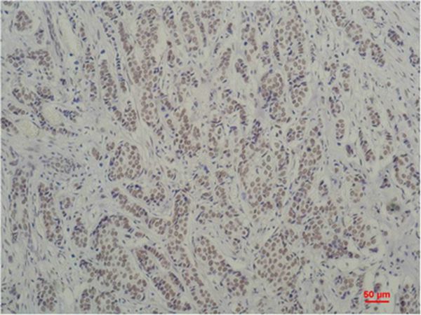 TBP/TATA Binding Protein Monoclonal Antibody(1F6)