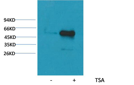 α-tubulin (Acetyl Lys40) Monoclonal Antibody(4A8)(4A8)