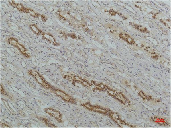 IκB β Monoclonal Antibody(8D11)