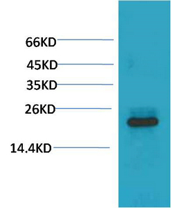 HSPB8/HSP22 Monoclonal Antibody(2C3)