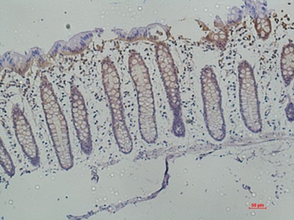 Galectin-3 Monoclonal Antibody(6B8)