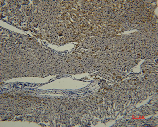 Transferrin Monoclonal Antibody(5E5)