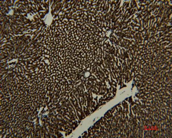 Transferrin Monoclonal Antibody(7H11)